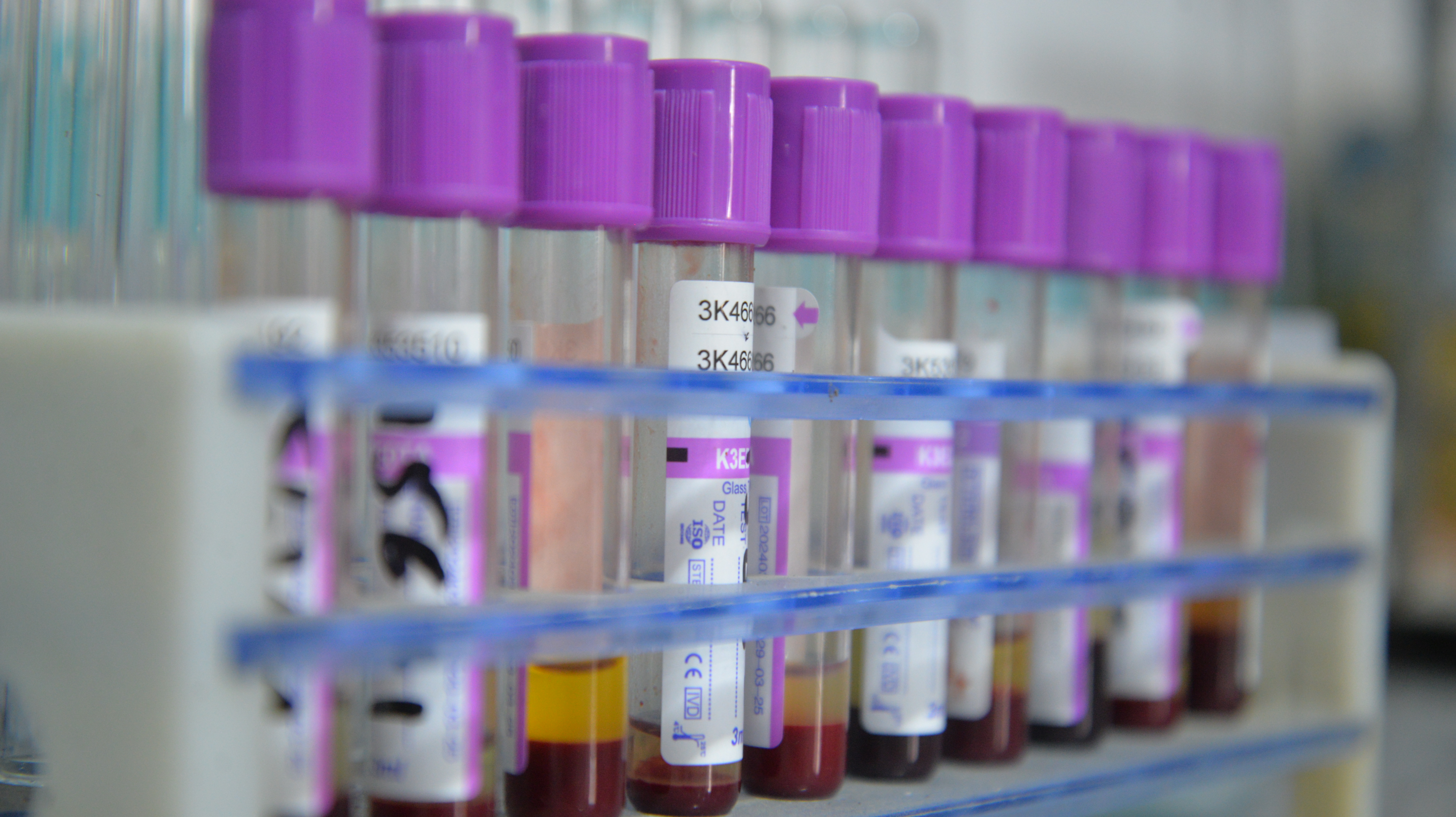 MLT Lab 1